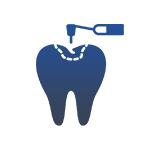 Fillings