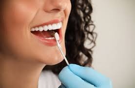 Are Dental Veneers Permanent? Are They a Permanent Solution?