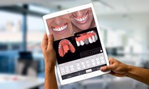 Digital Smile Design Dubai - Personalized Smile Makeover at Dr. Han Alahwany Clinic